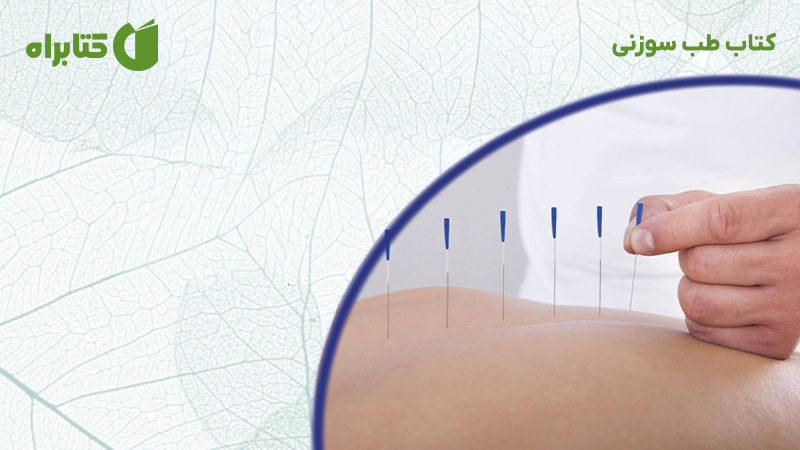 معرفی و دانلود کتاب طب سوزنی