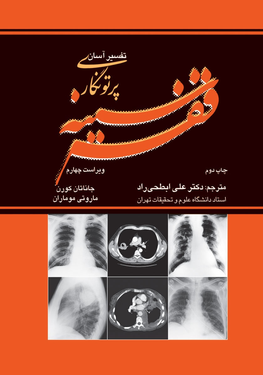 کتاب تفسیر آسان پرتونگاری قفسه سینه - ویراست چهارم