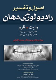 معرفی و دانلود کتاب اصول و تفسیر رادیولوژی دهان وایت فارو: بیماری‌های پریودنتال، بیماری‌های التهابی