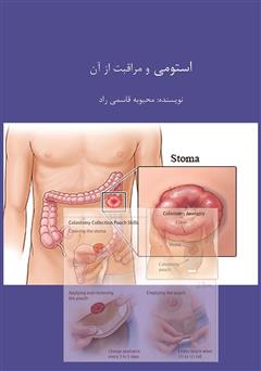 معرفی و دانلود کتاب استومی و مراقبت از آن