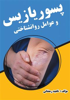 معرفی و دانلود کتاب پسوریازیس و عوامل روانشناختی