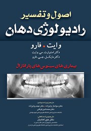 معرفی و دانلود کتاب اصول و تفسیر رادیولوژی دهان وایت فارو: بیماری‌های سینوس‌های پارانازال